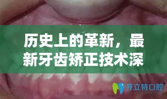 历史上的革新，最新牙齿矫正技术深度解析与介绍