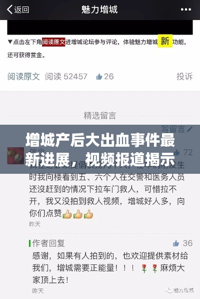 一张一弛